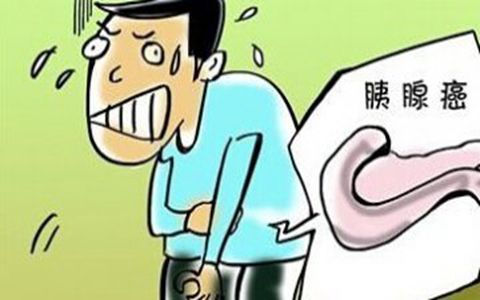 肚子疼小心胰腺癌做怪